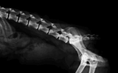 Rétrécissement foraminal : symptômes, traitements et exercices efficaces