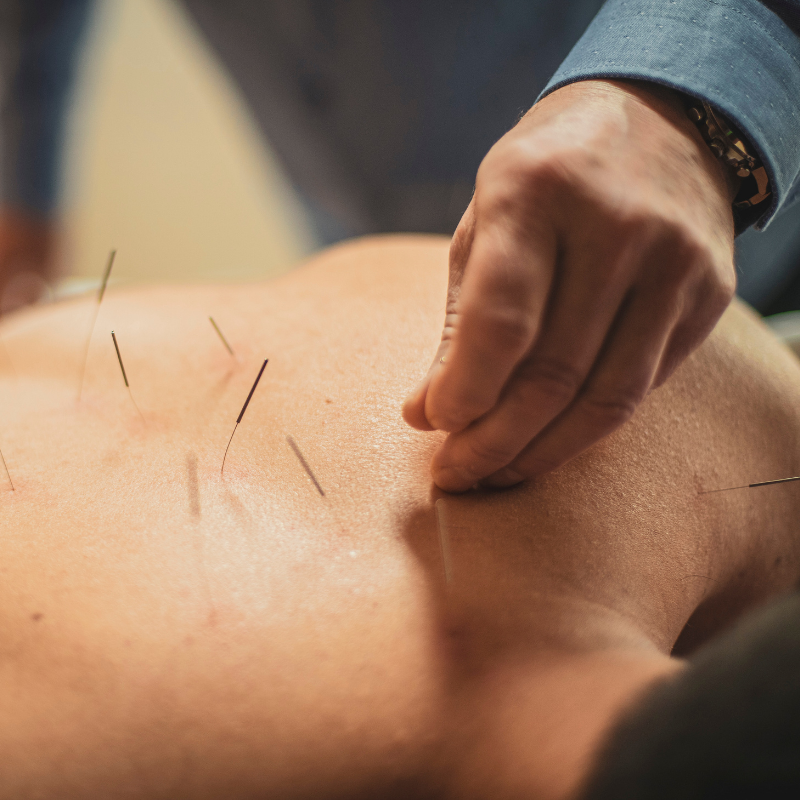 acupuncture pour cruralgie mouvements interdits pour cruralgie